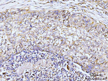 GIT1 Antibody