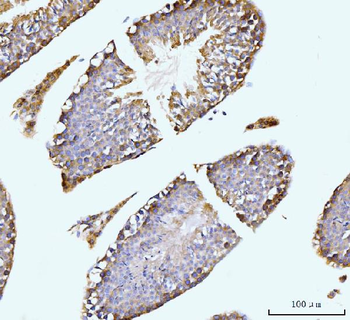 GIT1 Antibody