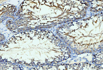 GIT1 Antibody