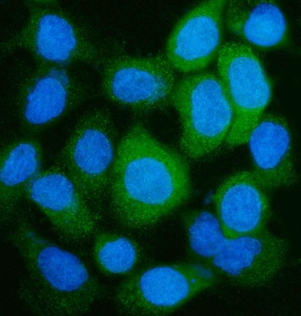 GLUL Rabbit Polyclonal Antibody