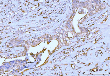 GNB3 Antibody