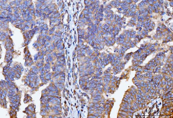 GNB3 Antibody
