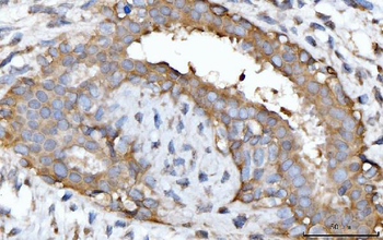 GNB3 Antibody