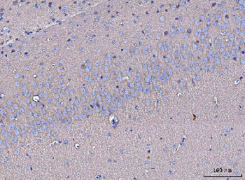 GNB3 Antibody