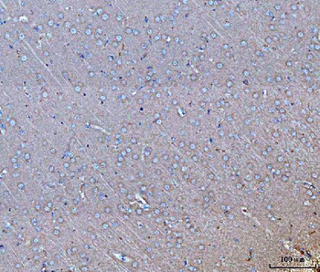 GNB3 Antibody