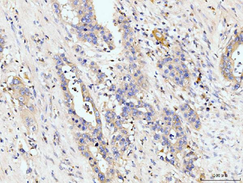 Golgin 97/GOLGA1 Antibody