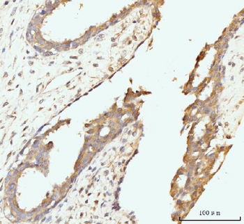 Golgin 97/GOLGA1 Antibody