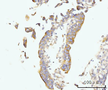 Golgin 97/GOLGA1 Antibody