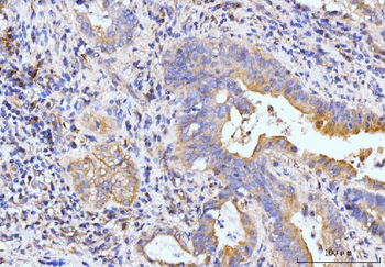 Golgin 97/GOLGA1 Antibody