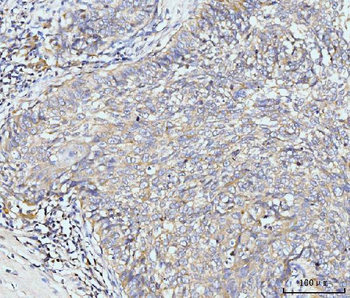 Golgin 97/GOLGA1 Antibody