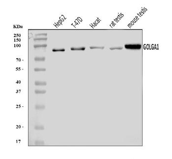 Golgin 97/GOLGA1 Antibody