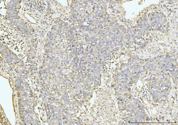 GRPEL1 Antibody