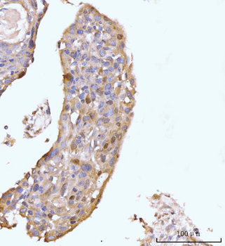 HMGCS1 Antibody