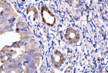 HMGCS1 Antibody