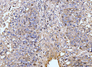HMGCS1 Antibody