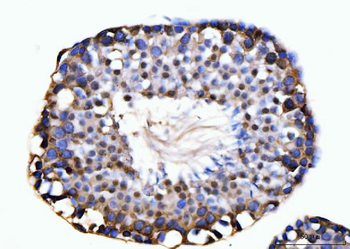 KIFC1 Antibody