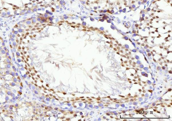 KIFC1 Antibody
