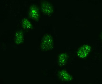 KIFC1 Antibody
