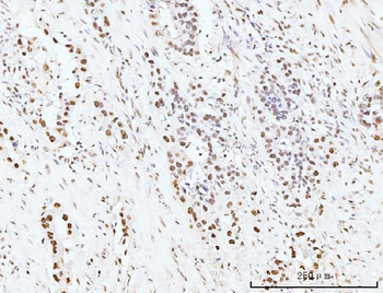 KIFC1 Antibody
