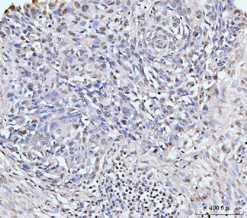KIFC1 Antibody