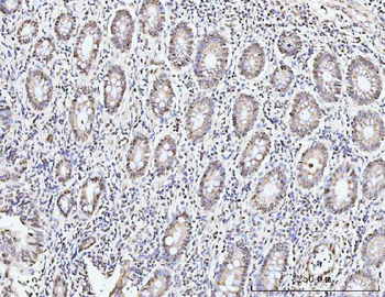 KIFC1 Antibody
