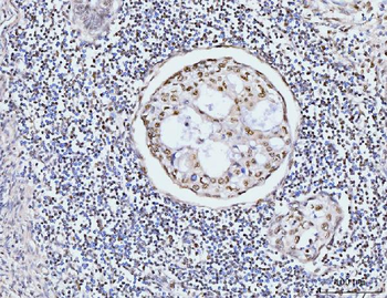 KIFC1 Antibody