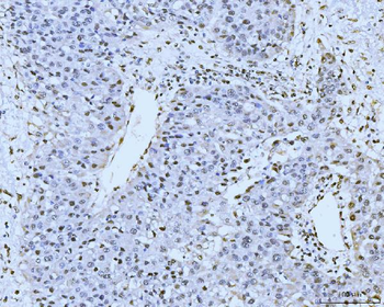 KIFC1 Antibody
