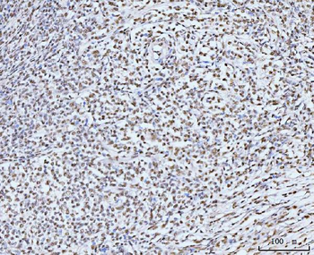 KIFC1 Antibody