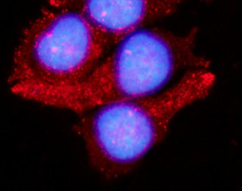 LAMTOR1 Rabbit Polyclonal Antibody