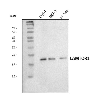 LAMTOR1 Rabbit Polyclonal Antibody