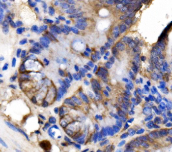 LSR Antibody