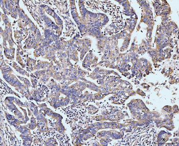 MAP4K1/HPK1 Rabbit Polyclonal Antibody
