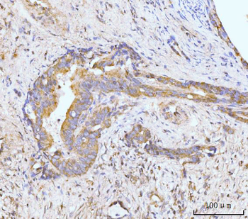 MAP4K1/HPK1 Rabbit Polyclonal Antibody