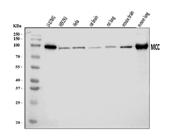 MCC Rabbit Polyclonal Antibody