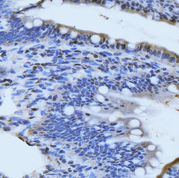 MRE11 Antibody