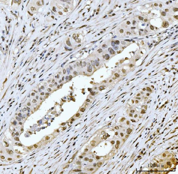 MRE11 Antibody