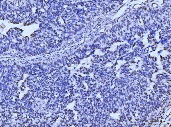 MRE11 Antibody