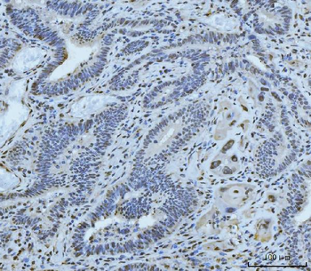 MRE11 Antibody