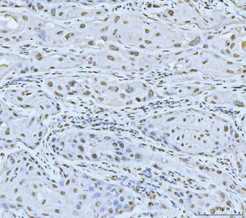 MRE11 Antibody
