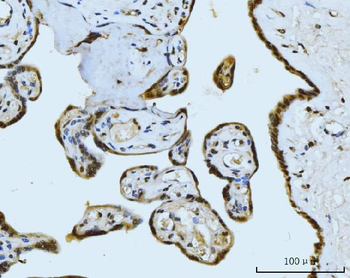 MRE11 Antibody