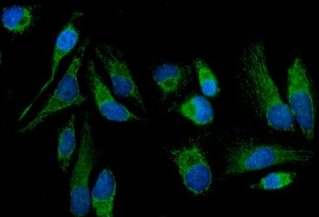 MT-ND5 Antibody