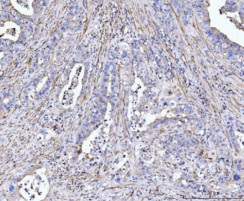 MT-ND5 Antibody