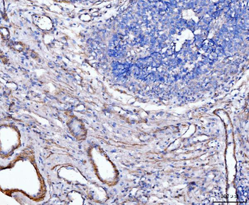 MT-ND5 Antibody
