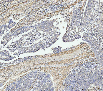 MT-ND5 Antibody