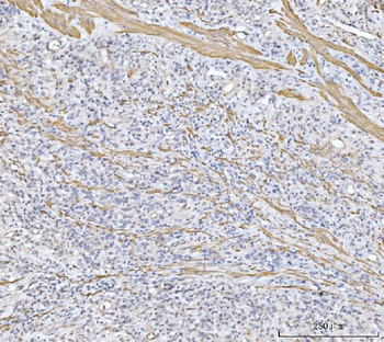 MT-ND5 Antibody