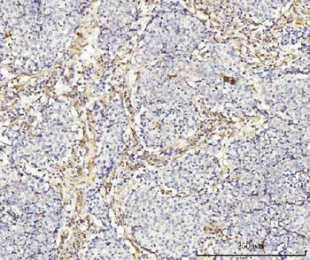 MT-ND5 Antibody