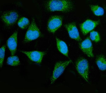 MTMR2 Rabbit Polyclonal Antibody