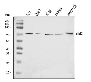 MTMR2 Rabbit Polyclonal Antibody