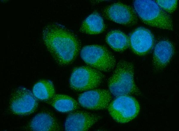 OS9 Rabbit Polyclonal Antibody
