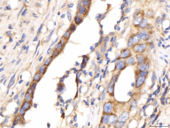 PDE4DIP Antibody